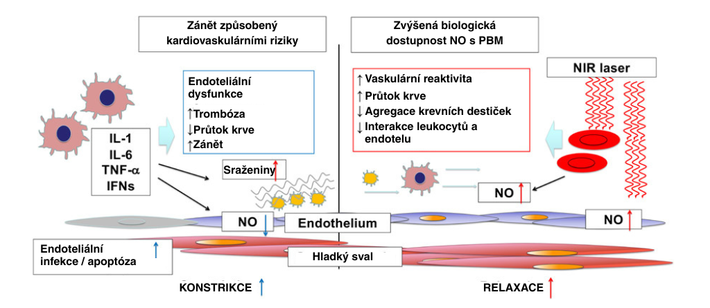 kardiovaskulární rizika